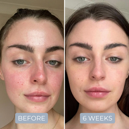 PDRN Peptide Foundational Repair Serum