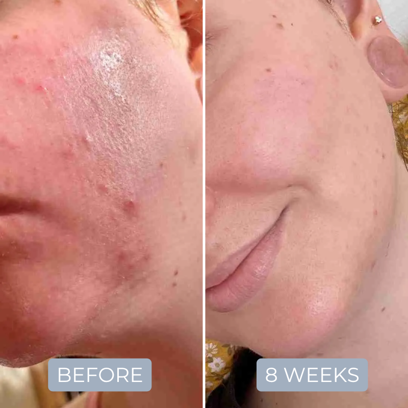 PDRN Peptide Foundational Repair Serum