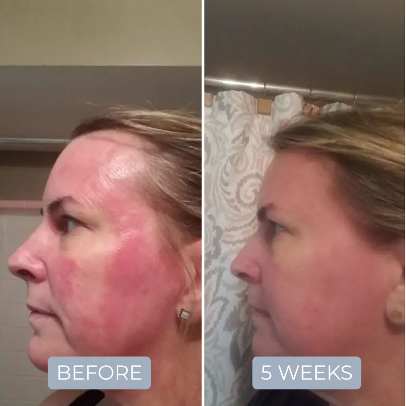 PDRN Peptide Foundational Repair Serum